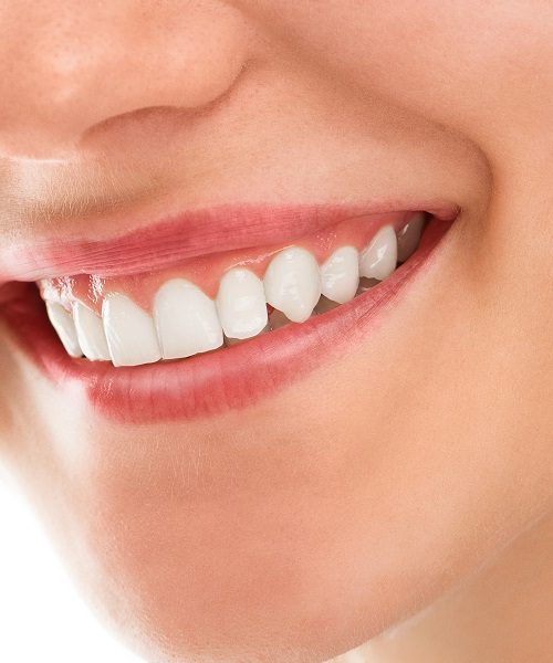 gum-health-basics