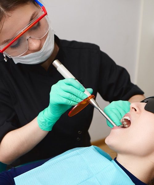 Dental Cavities